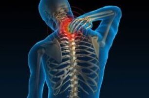Cervical osteochondrosis causes pain in the neck